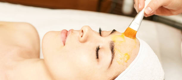 Bridal Chemical Peels in Dubai: The Ultimate Wedding Glow Timeline