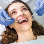 What Is the Best Age to Start Orthodontic Treatment?