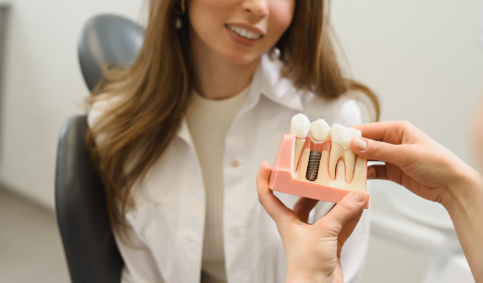 Bone Loss and Dental Implants: What Patients Should Know