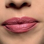 Is Lip Reduction Surgery Suitable for All Lip Types?