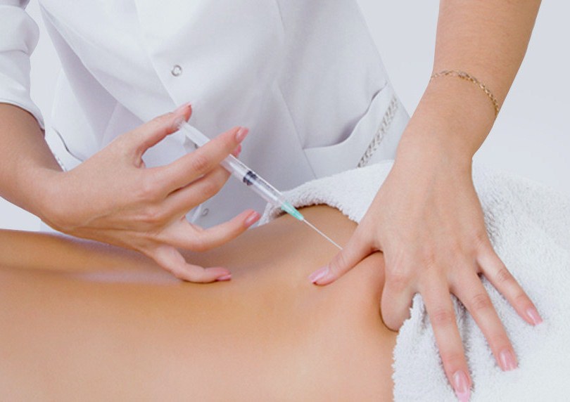 Can Butt Fillers Help Achieve a Fuller Appearance Fast?