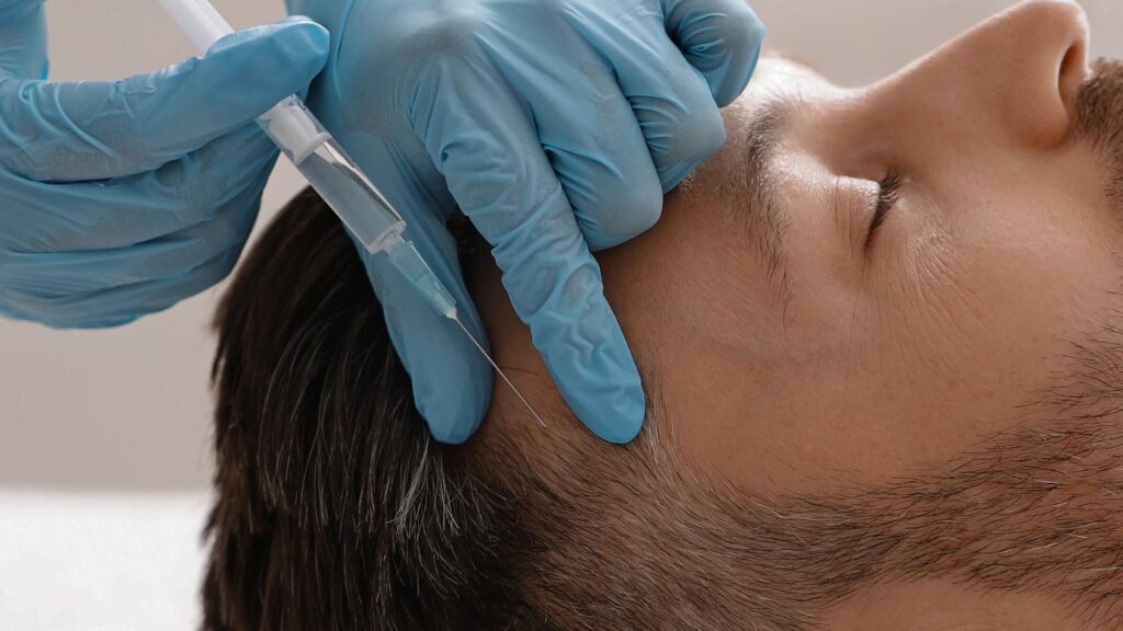 Why Is PRP a Preferred Option for Hair Thinning Solutions?