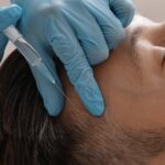 Why Is PRP a Preferred Option for Hair Thinning Solutions?