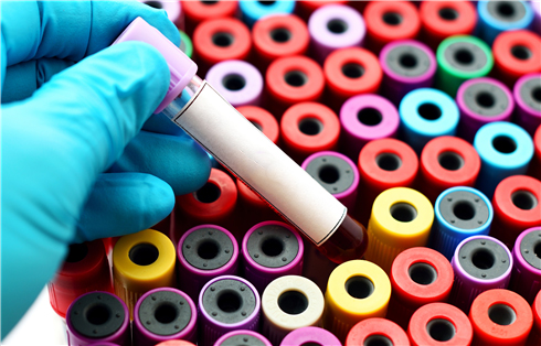 Understanding Immortalized Human Primary Trabecular Meshwork Cells-SV40