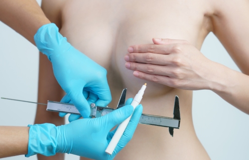 Inverted Nipple Surgery for Flat Nipples vs Inverted Nipples