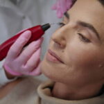 Plasma Pen Treatment in Dubai: Is It Worth the Hype?