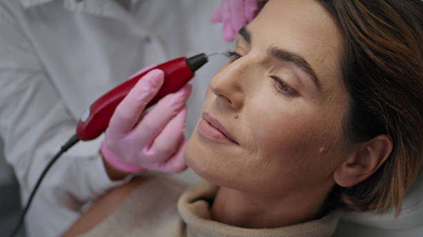 Plasma Pen Treatment in Dubai: Is It Worth the Hype?