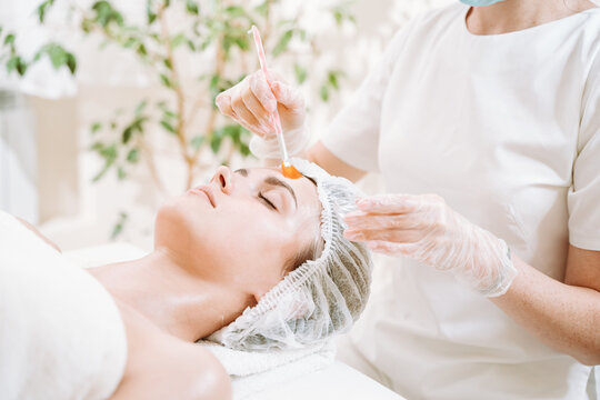 Can PCA Peel Treatment Help Achieve Radiant Skin?