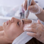 Microneedling Treatment in Dubai for Surgical Scars | Repair