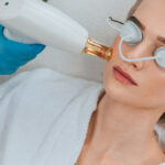 Does Laser Hair Bleaching Require Recovery Time?