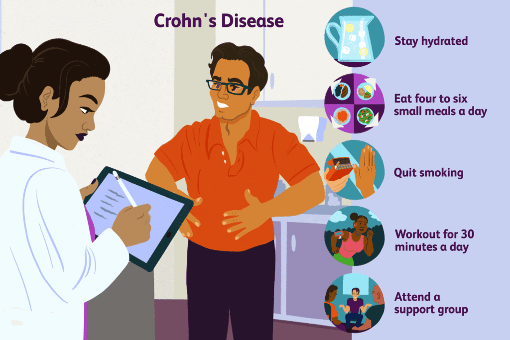 Crohn’s Disease Treatment and Lifestyle Changes