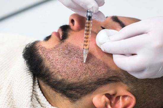 دبي 2026: عصر جديد لزراعة شعر الوجه