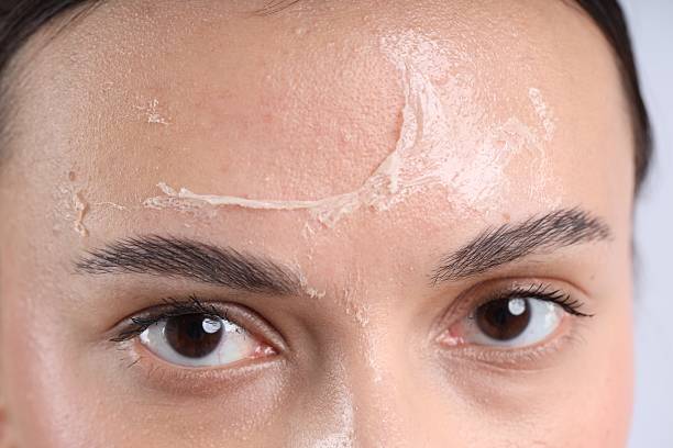 Radiance Peeling in Dubai After Fillers and Botox: Timing Guide