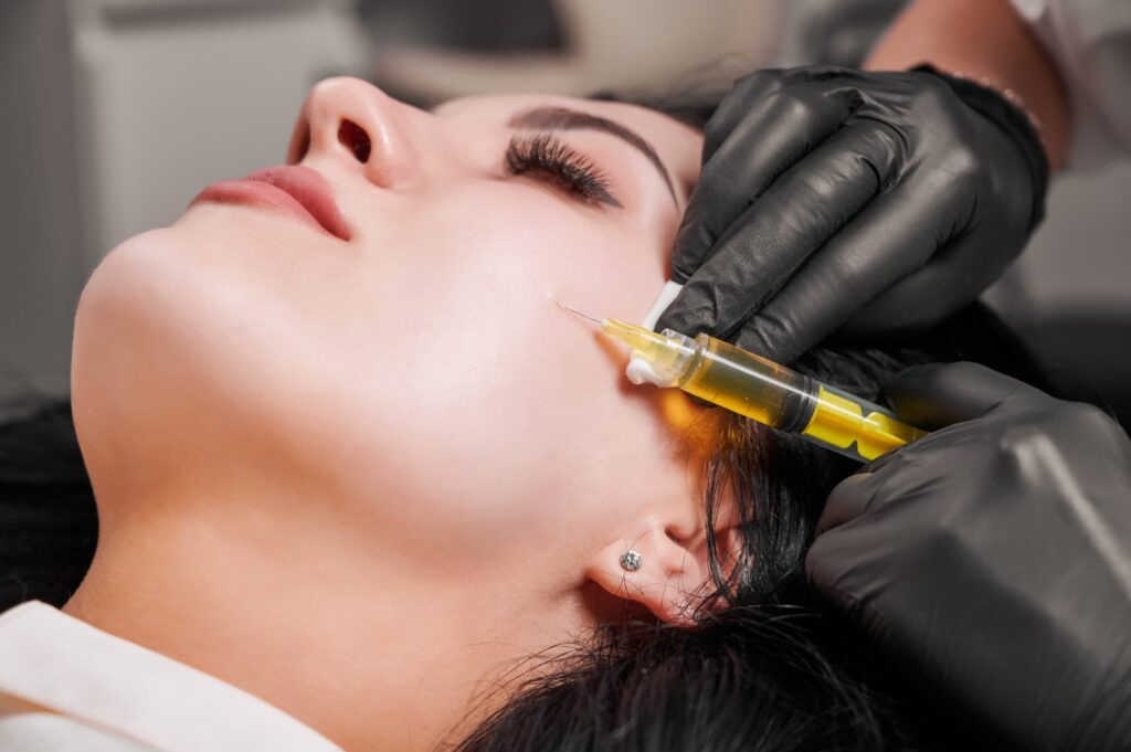 How Cheek Fillers in Dubai Restore Youthful Facial Volume