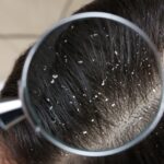 Benefits of pH Balanced Shampoo for Oily Scalp and Hair Strength