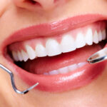 Emergency Dentist Houston Guide: What to Do Before You Arrive