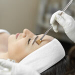 Benefits of Getting Chemical Peels in Islamabad for Glowing Skin