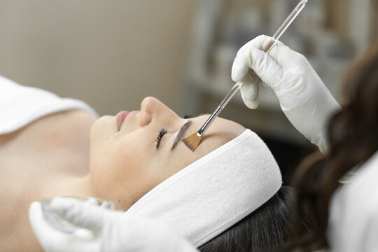 Benefits of Getting Chemical Peels in Islamabad for Glowing Skin