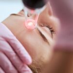 Does Pico Laser Treatment Reduce Pigmentation Safely?