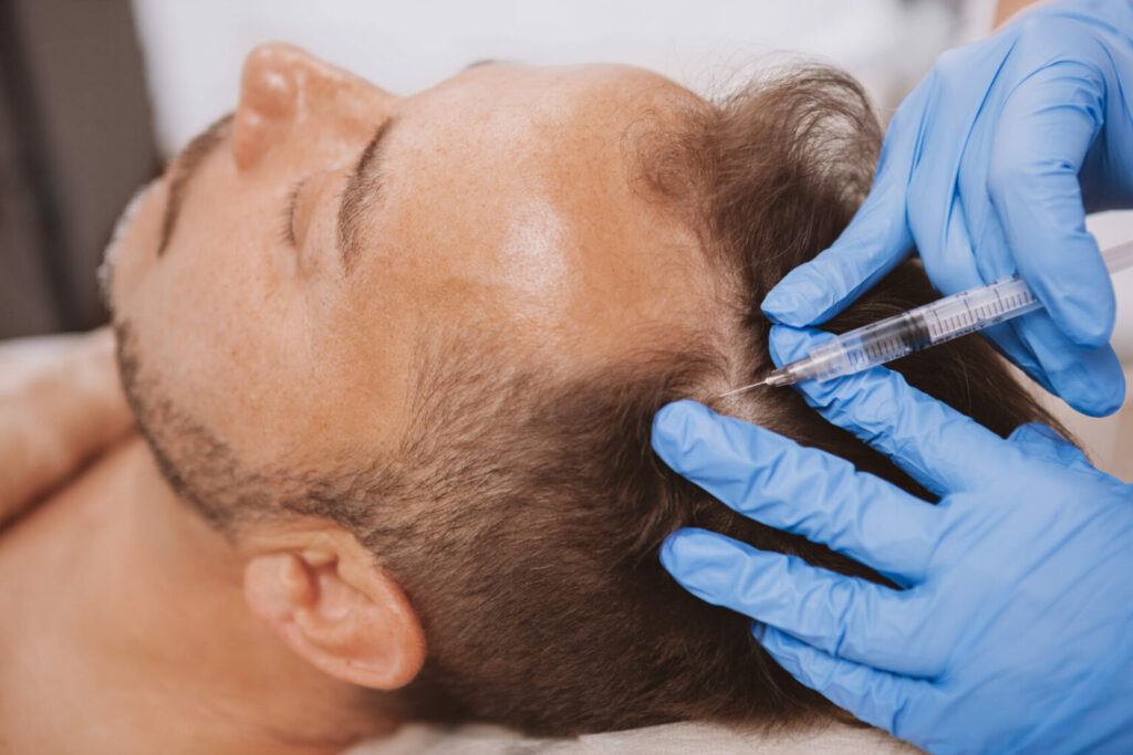 Key Features That Make Modern Hair Systems Look Completely Natural