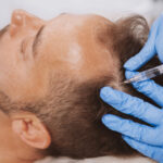 Key Features That Make Modern Hair Systems Look Completely Natural