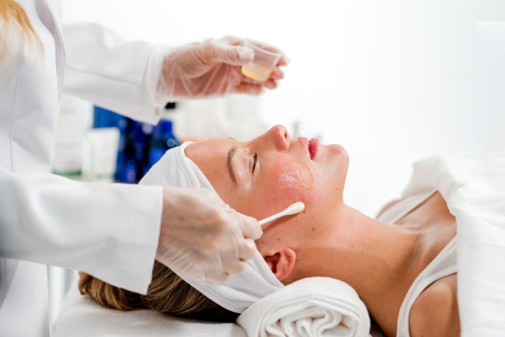 Are Chemical Peels in Islamabad Effective for Melasma?