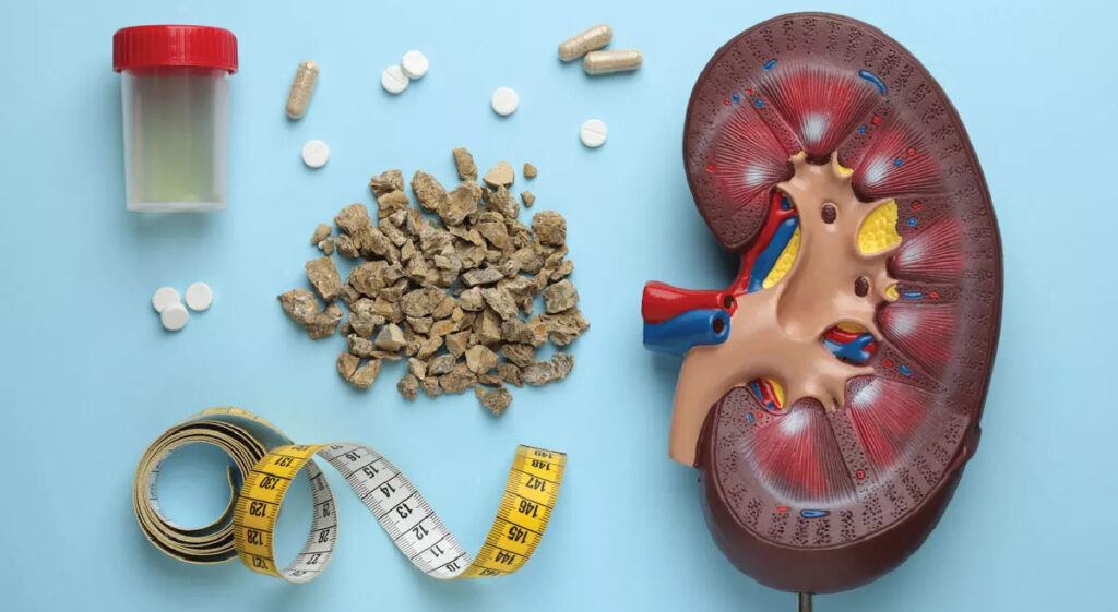 Everything You Should Know About Kidney Stones Treatment
