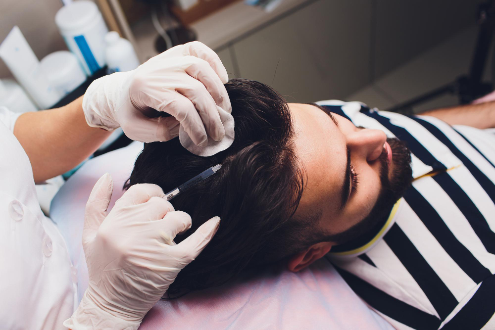 Home vs. Clinic: Best Scalp Treatments for Hair Loss in the Philippines