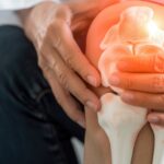 From Knee Pain to Better Mobility: A Practical Guide to Knee Arthritis Care in Greater Noida