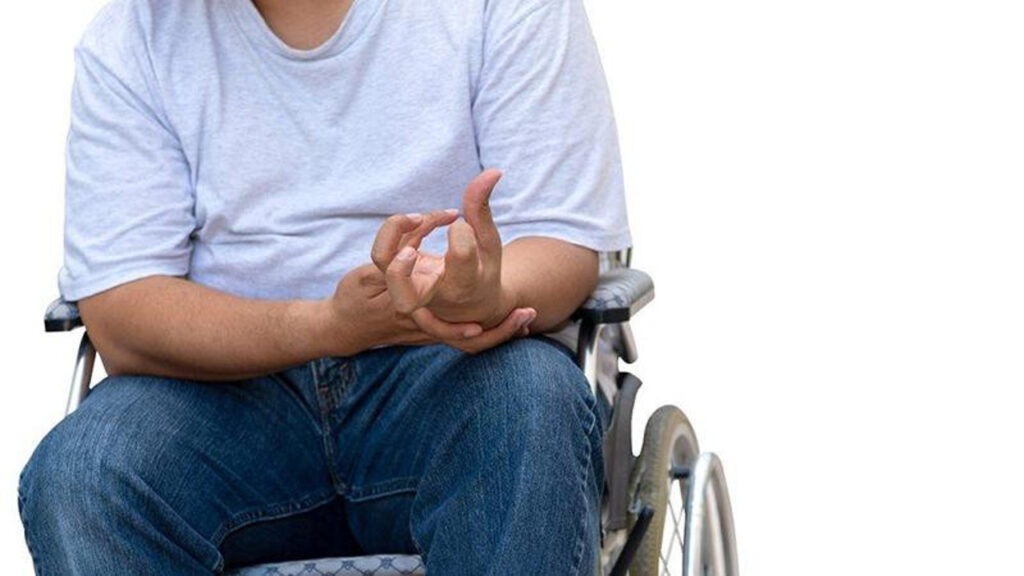 Early Treatment for Paralysis: Why Timing Matters