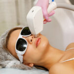 Is Laser Hair Bleaching Helpful for Daily Skin Care?