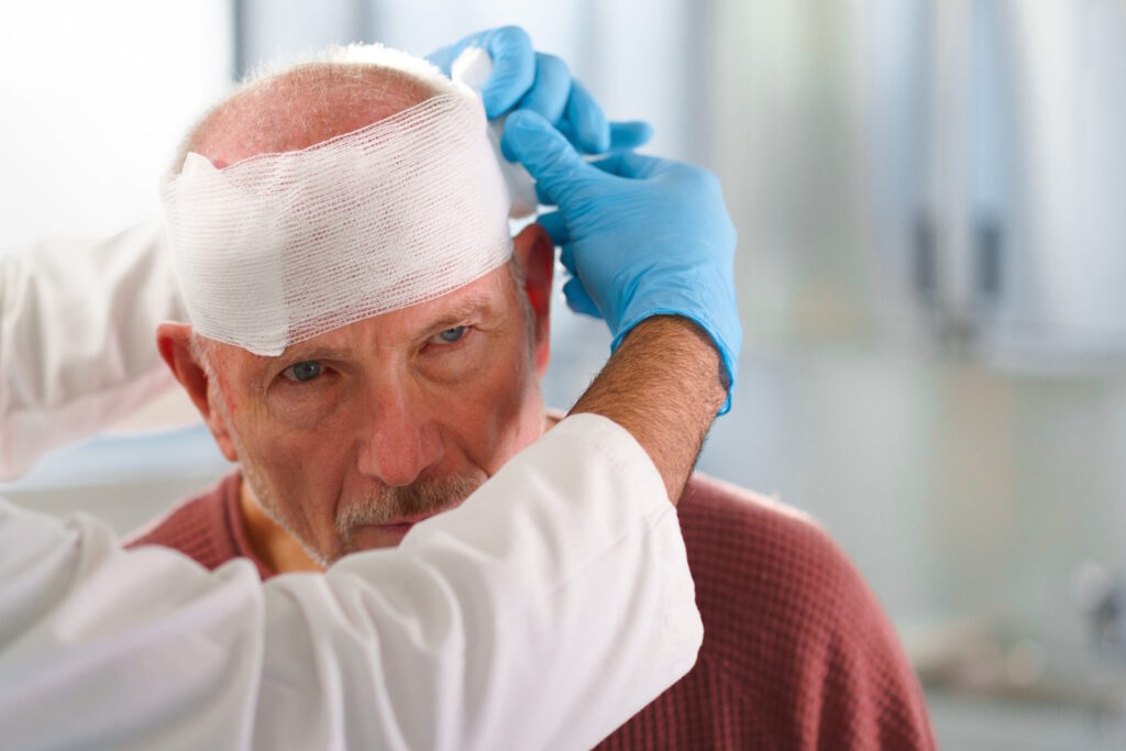Choosing the Right Head Injury Solicitors for Your Compensation Claim