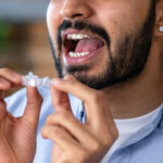 Top Advantages of Choosing Invisible Braces