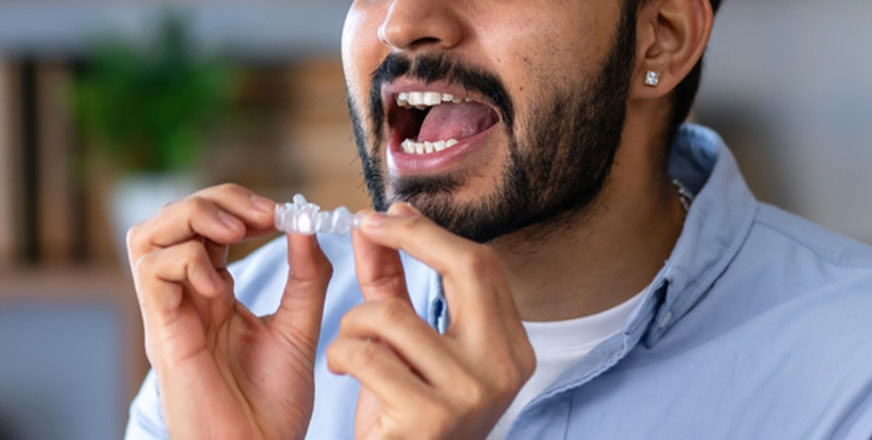 Top Advantages of Choosing Invisible Braces