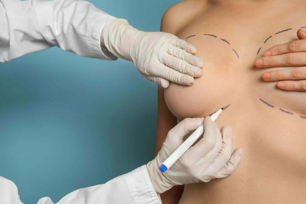 What to Expect During Breast Augmentation in Islamabad Procedure