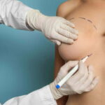 What to Expect During Breast Augmentation in Islamabad Procedure