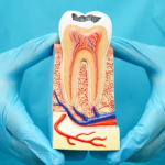 A Complete Guide to Root Canal Treatment