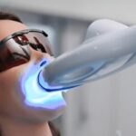 How Laser Teeth Whitening Works: A Complete Guide