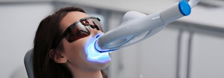 How Laser Teeth Whitening Works: A Complete Guide
