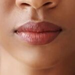 Achieve Naturally Pink Lips with Smoker Lips Treatment in Islamabad
