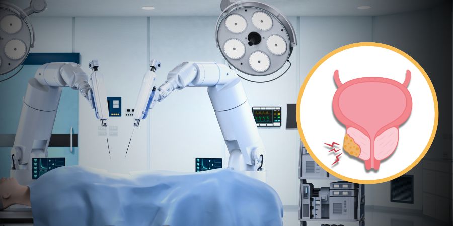 Robotic Prostatectomy: Revolutionizing Prostate Cancer Treatment