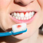 Common Types of Gum Treatment Explained