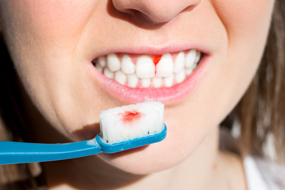 Common Types of Gum Treatment Explained