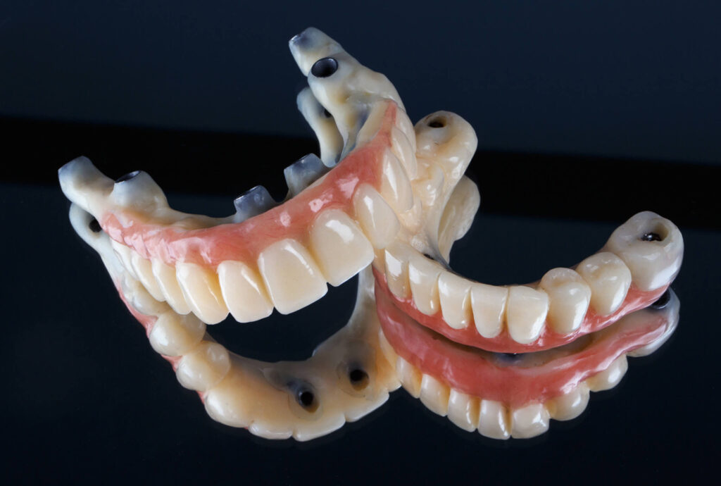 Why More Locals Are Trusting a Nambour Dentist for Family Dental and Teeth Whitening
