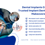 Dental Implants Coventry 2026 | Affordable Tooth Replacement | Spencer Road Dental Surgery