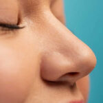 Alarplasty for Better Facial Balance