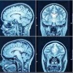 Understanding the CT Scan Cost in Bangalore: A Comprehensive Guide by Ecotown