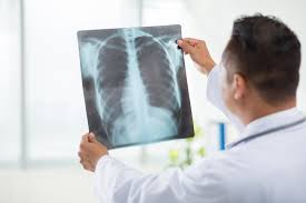 X Ray Lab Near Me: Your Guide to Advanced Imaging Services