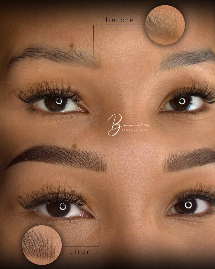 Can Eyebrows Microblading Help Brows Damaged by Overplucking?