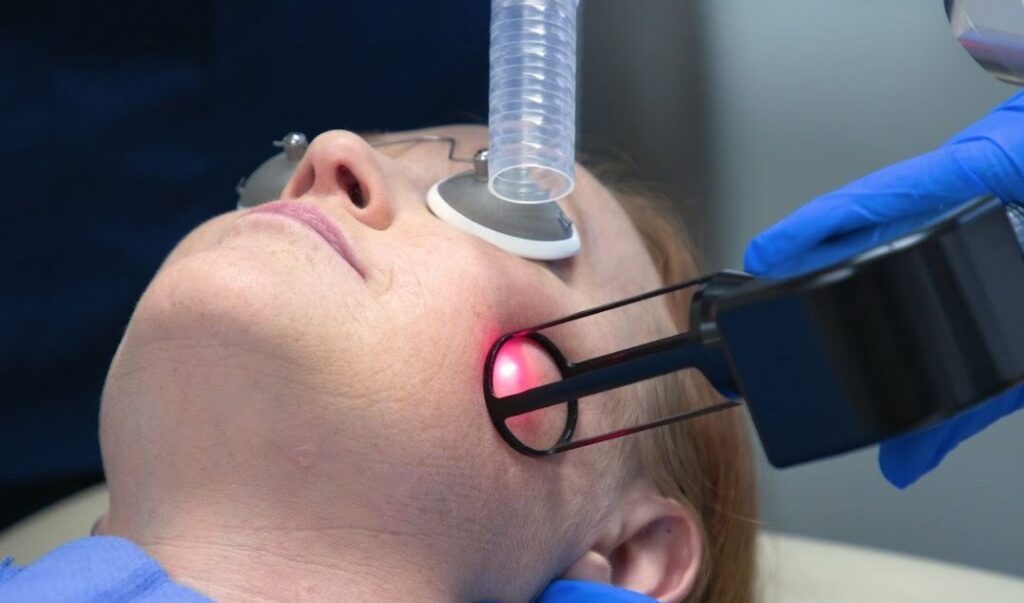 Latest Trends in CO2 Laser Treatments in Islamabad